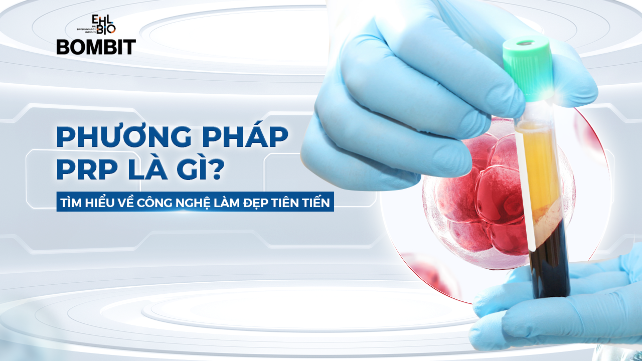 phuong-phap-prp-la-gi