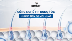 Công nghệ trị rụng