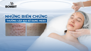 Những biến chứng thường gặp khi sử dụng MESO