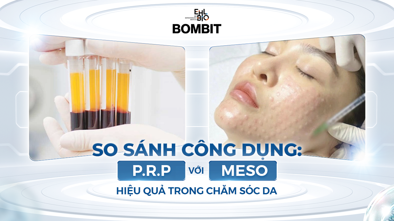 So sánh công dụng P.R.P với MESO