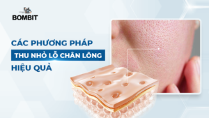 phương pháp thu nhỏ lỗ chân lông