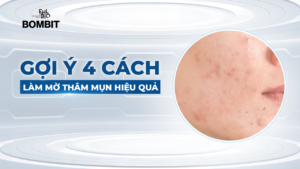 cách làm mờ thâm mụn