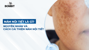 nám nội tiết là gì