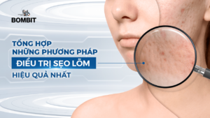 phương pháp điều trị sẹo lõm