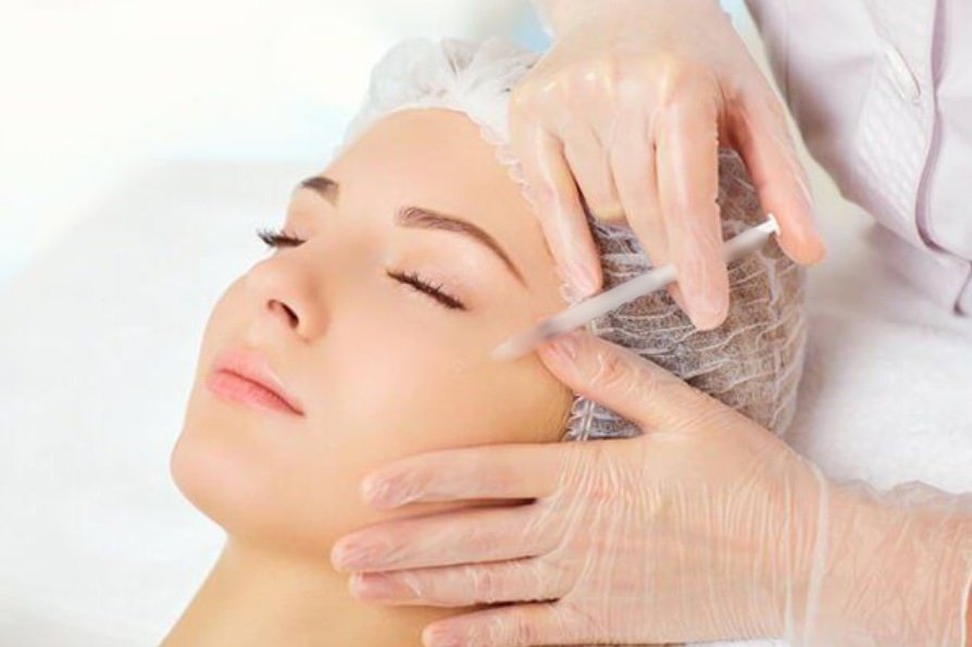 phương pháp mesotherapy