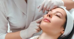 Phương pháp mesotherapy là gì